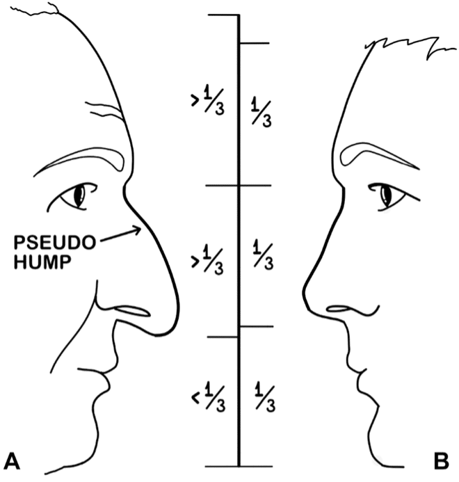 Do I have an Old Nose?