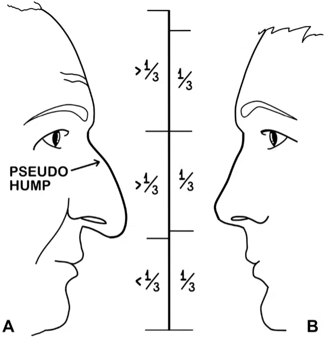 Do I have an Old Nose?