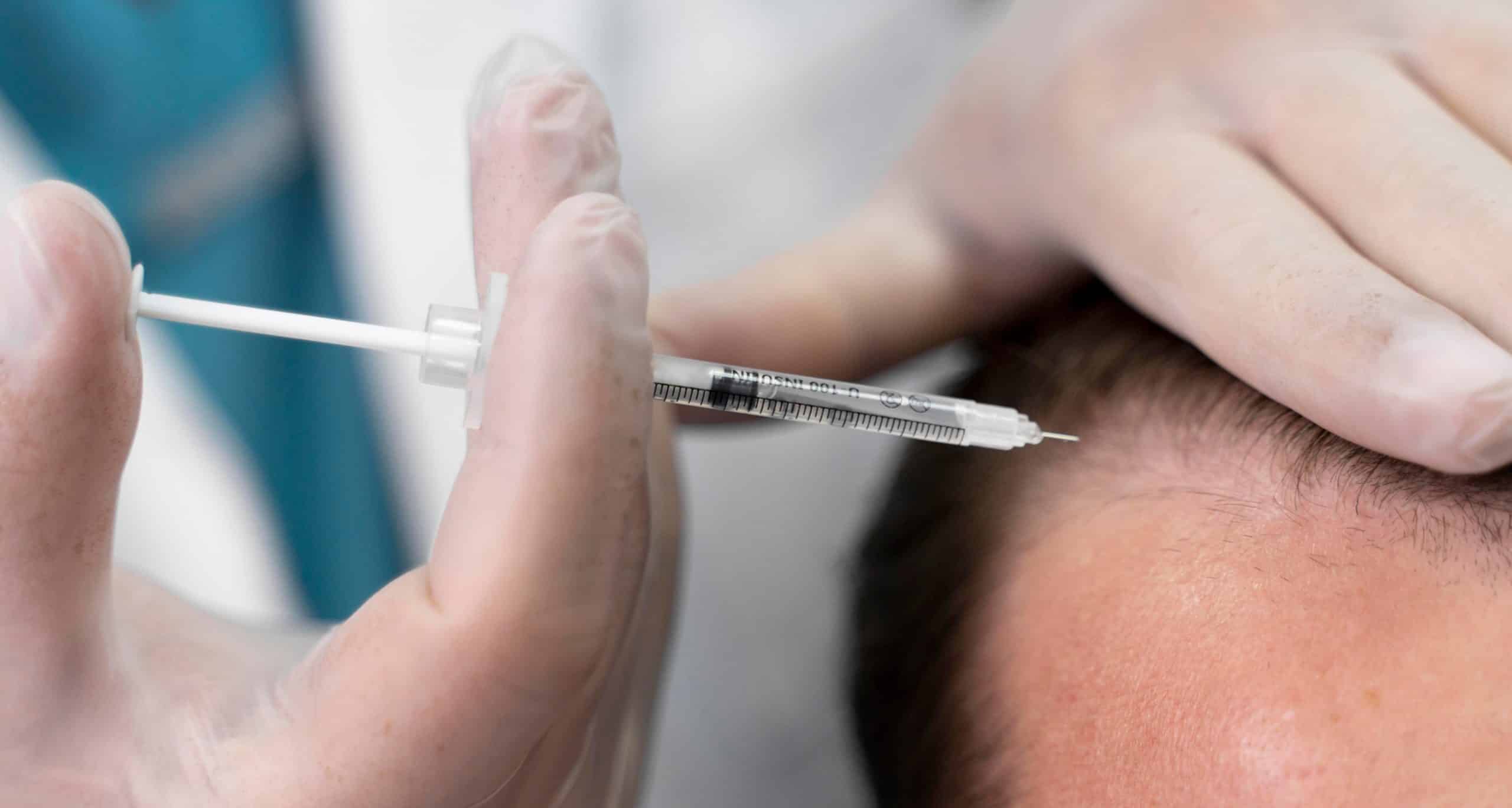 Adult male doing follicular unit extraction 1