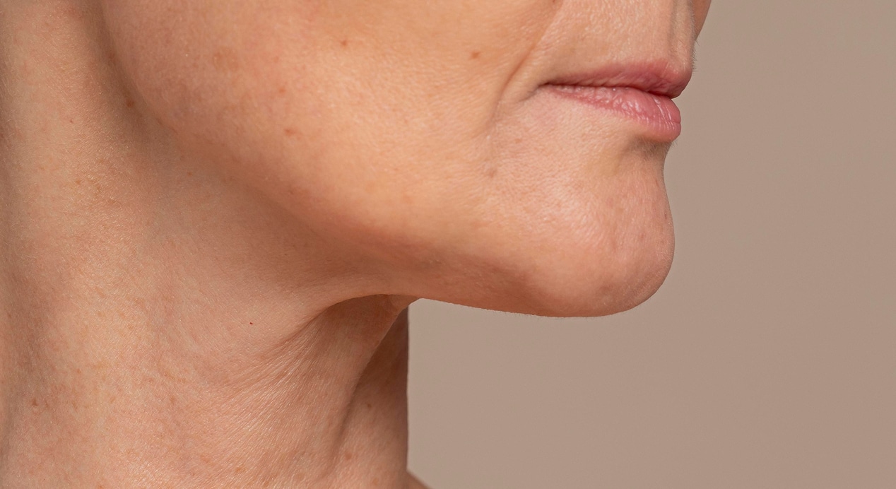 Antiaging beauty treatment 1