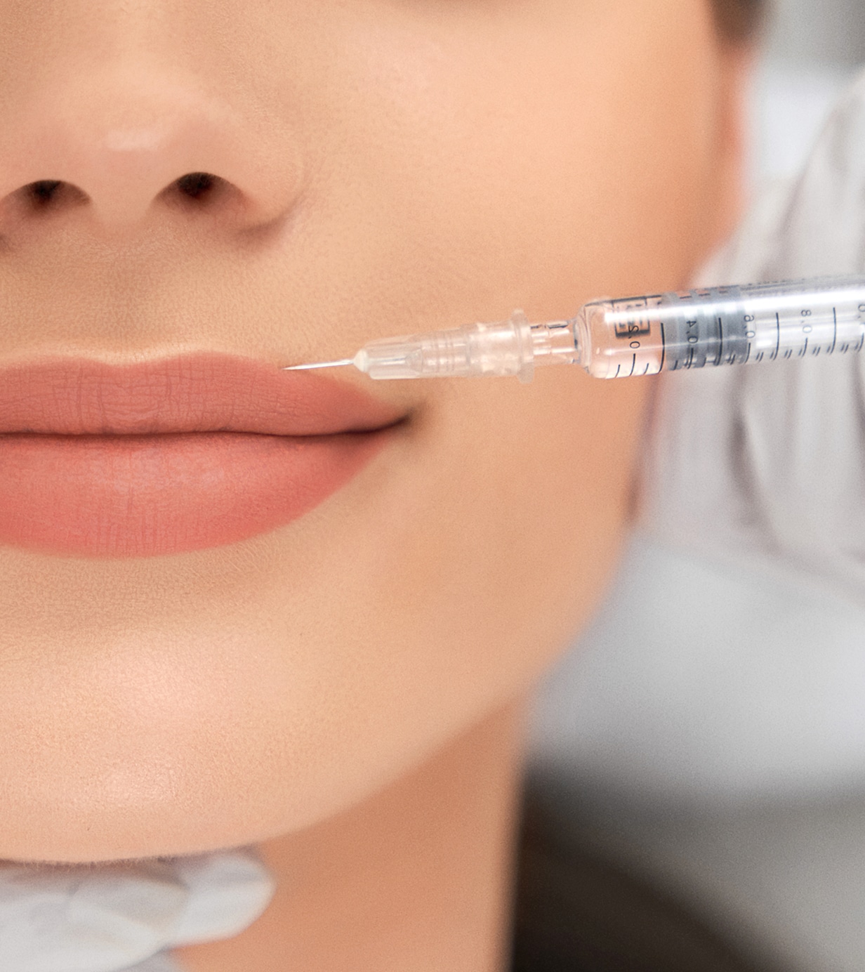 Augmentation improvement lips professional salon 1