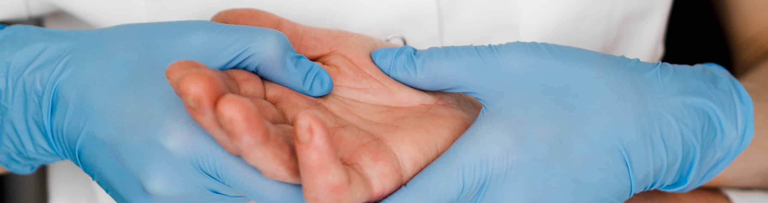 Close up doctor checking palm 1