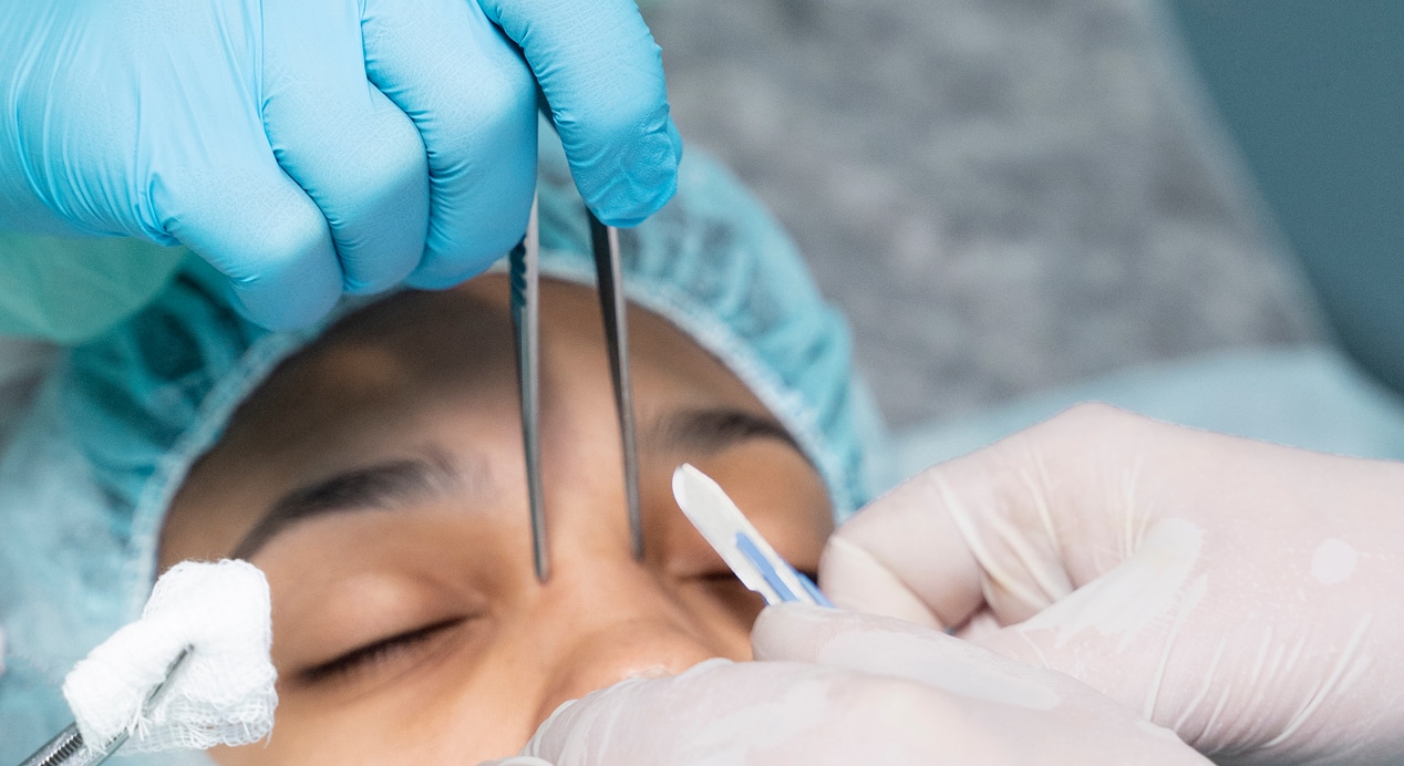 Close up doctors performing rhinoplasty 1
