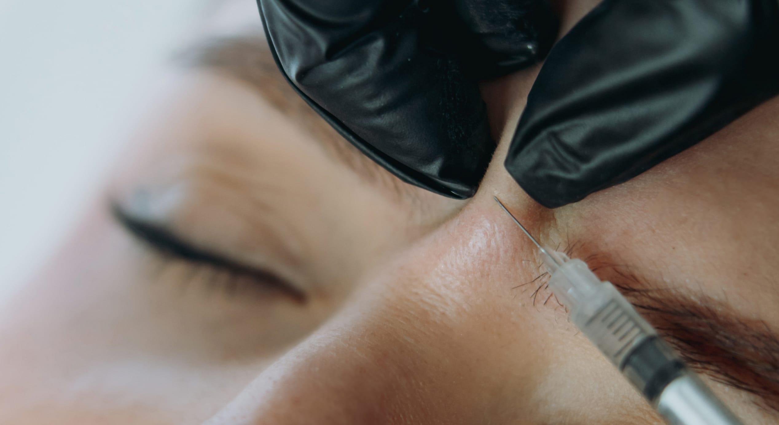 Close up professional hands making botox ingection into woman frown line 1