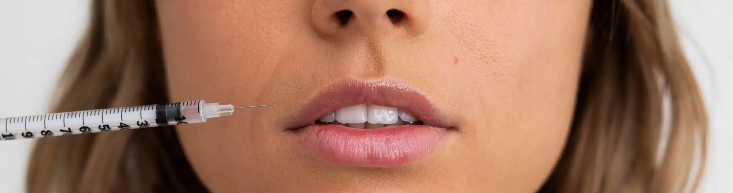 Woman receiving lip filler treatment