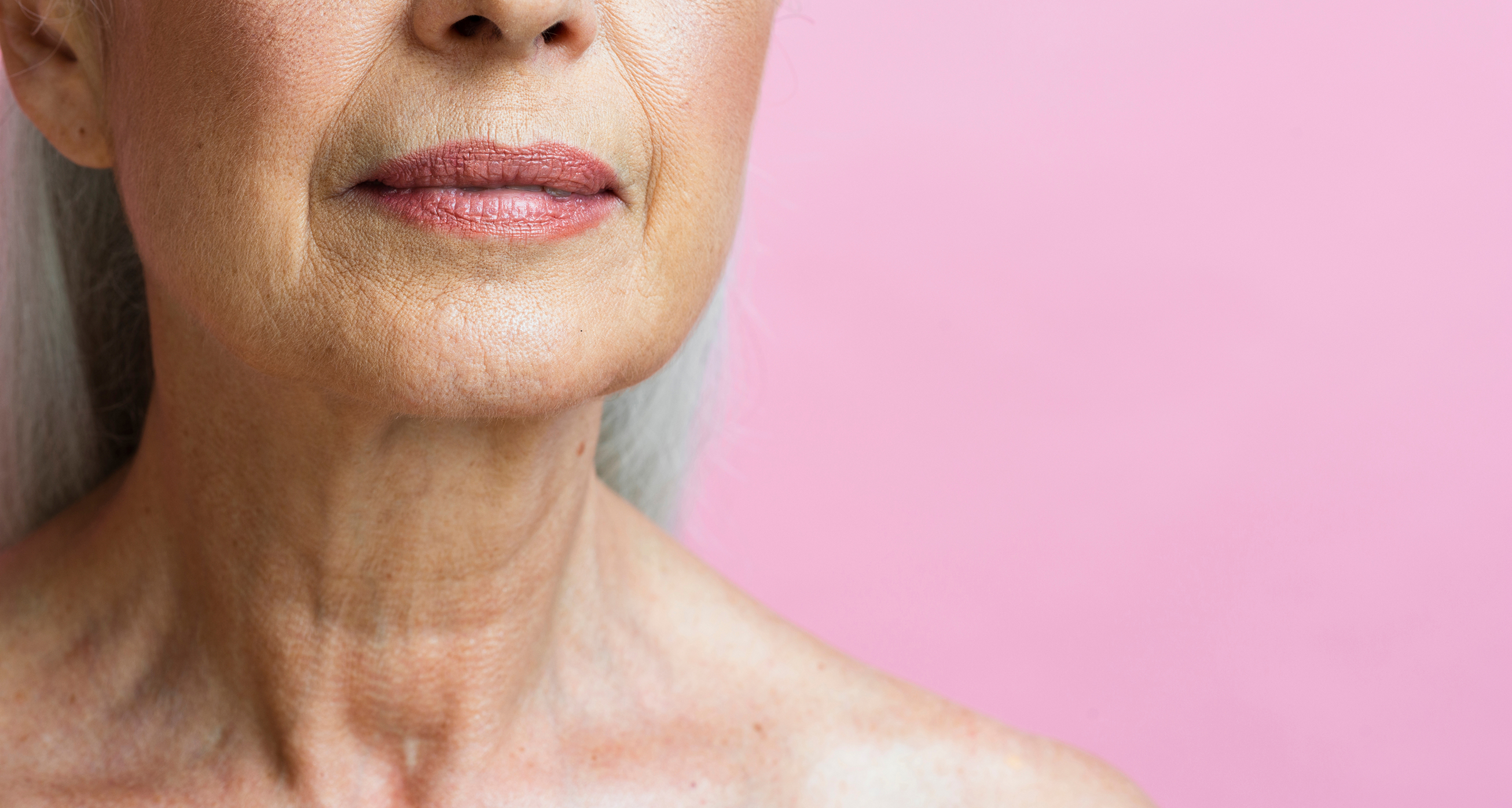 Neck / Nefertiti Lift treatment at Battersea Hospital