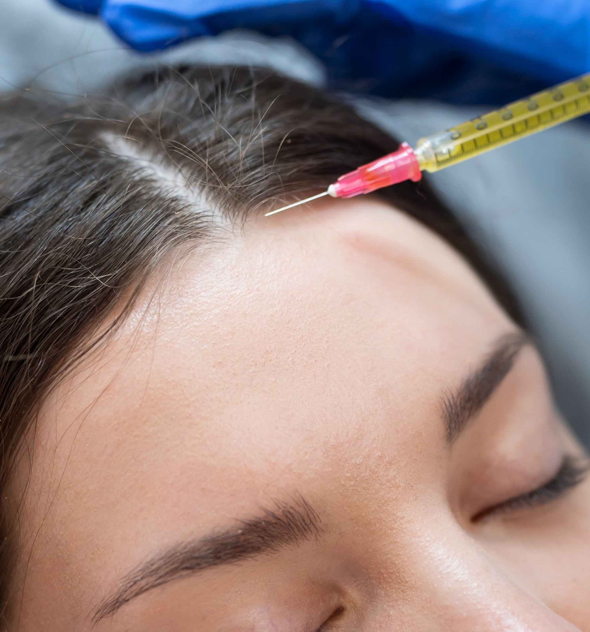 Close up young woman getting prp injection 1