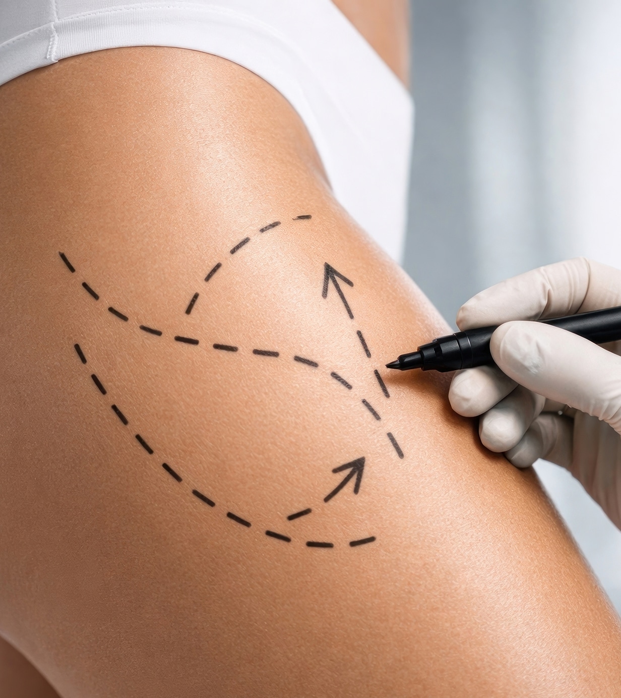 Cosmetic surgery planning illustration 1