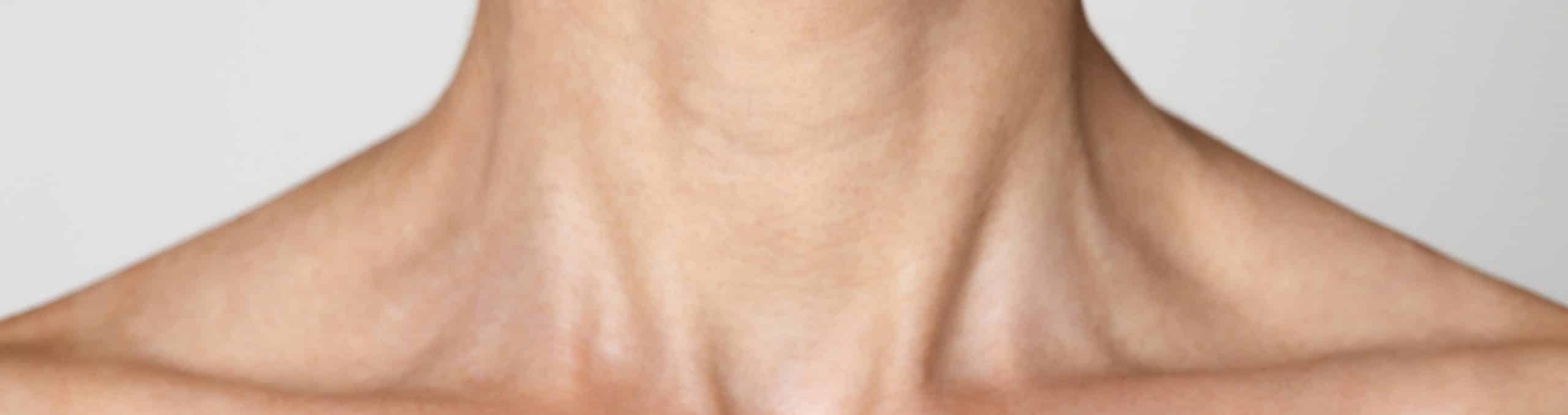 Cropped womans neck chin woman is wearing light color shirt has neutral 1