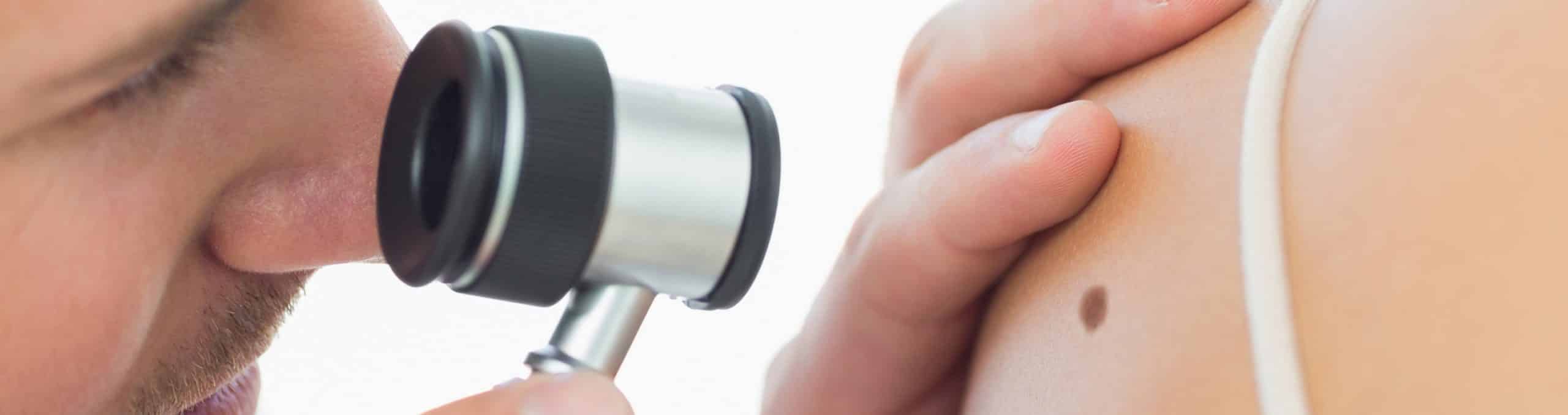 Doctor checking mole woman 1