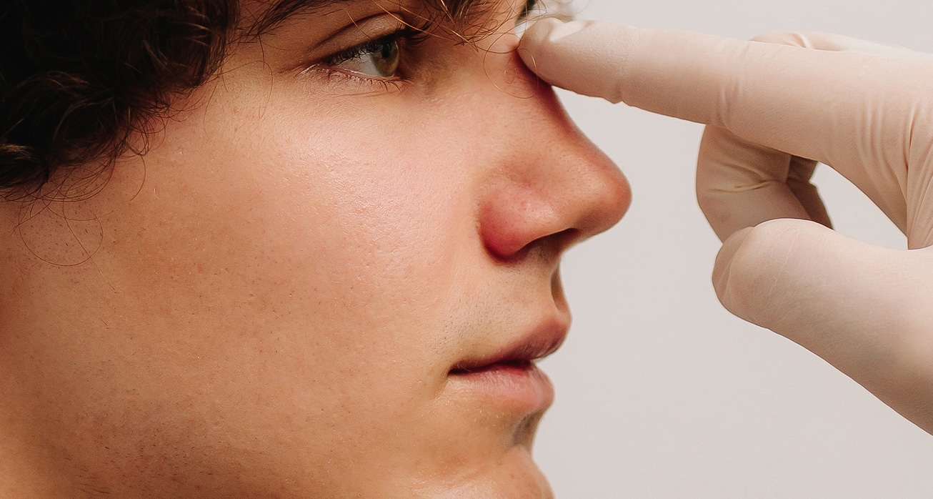 Ent doctor touching nose patient before rhinoplasty septoplasty surgery rhinoplasty change size shape nose fix issues…