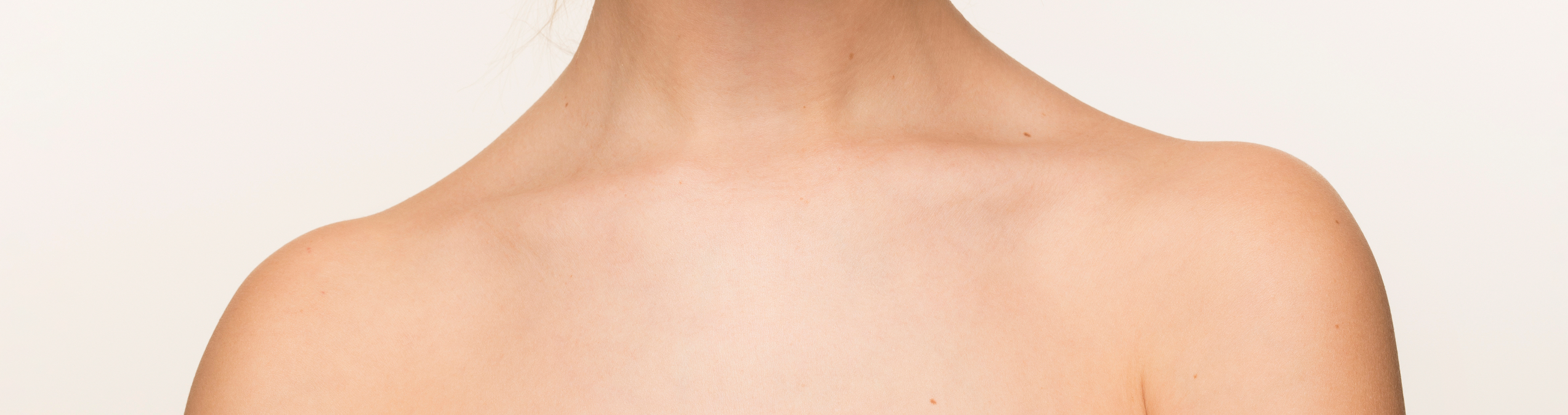 Trapezius / Shoulder Slimming at Battersea Hospital