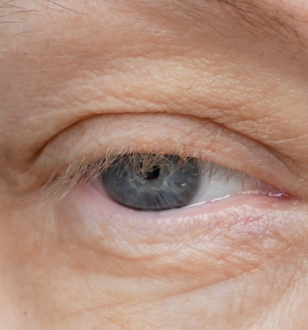 Middle aged female s eye with drooping eyelid making eyebrow makeup ptosis is drooping 1 1