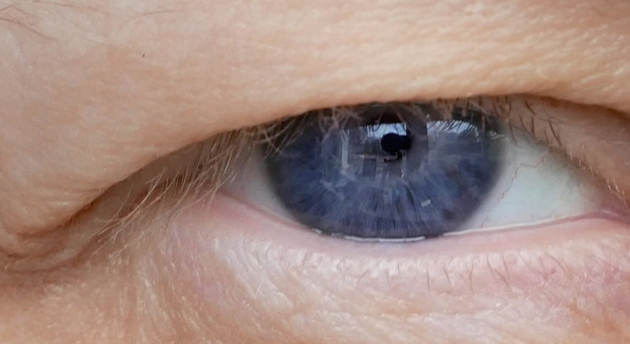 Middle aged females eye with drooping eyelid making eyebrow makeup ptosis is drooping eye 1