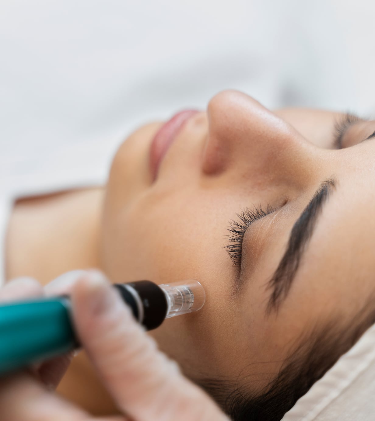 Person getting micro needling beauty treatment 1