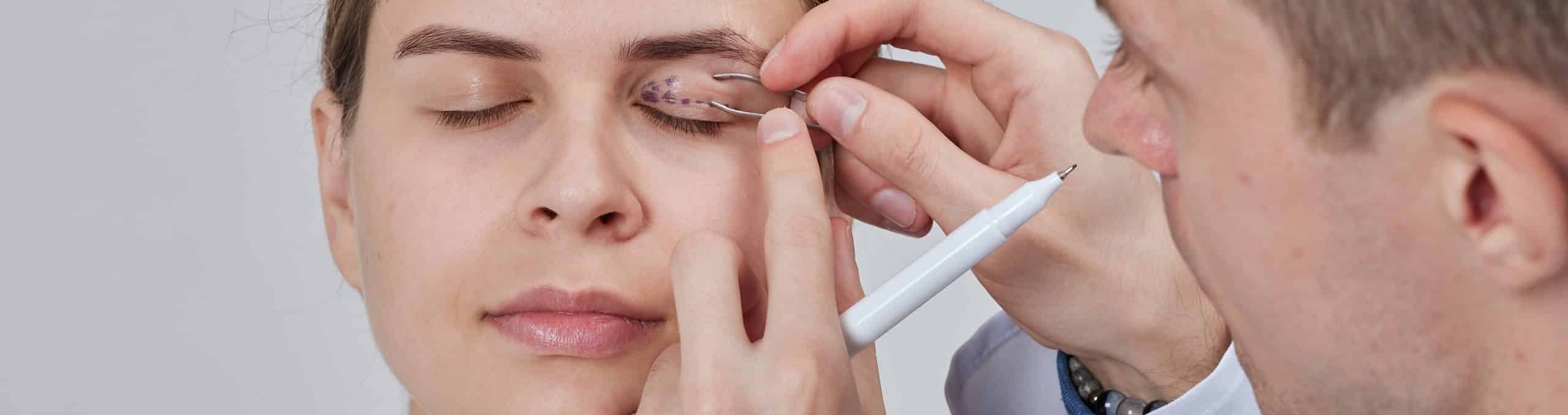 Plastic surgeon prepares blepharoplasty blepharoplasty operation 1