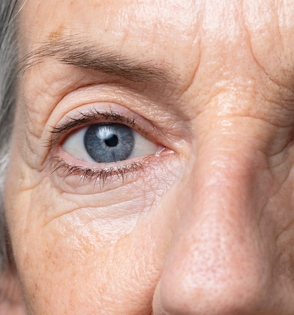 Senior woman skin texture front view 1 1