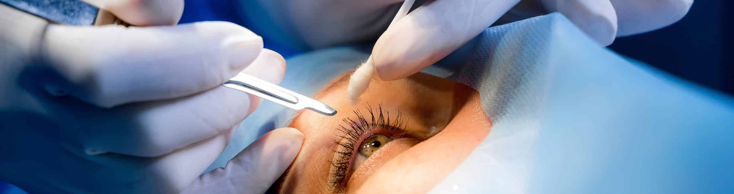 Surgeon is performing surgery patients eye using scalpel forceps 1