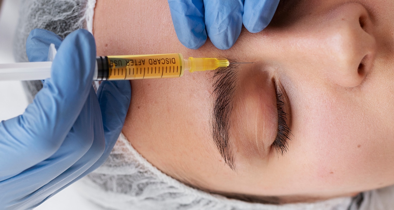 View woman getting face prp treatment 1