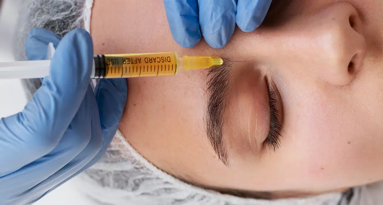 Woman receiving platelet-rich plasma treatment on her face