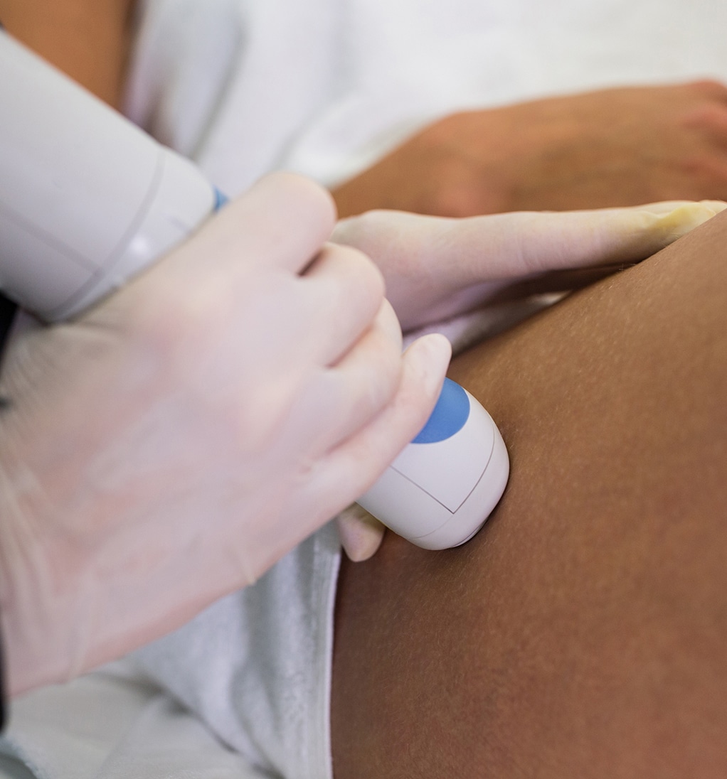 Woman receiving laser epilation treatment her thigh 1
