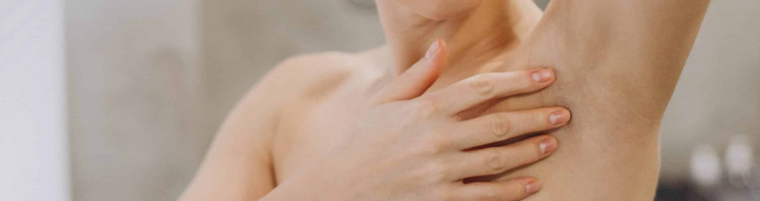Woman showing arritated skin arm after deodorant 1