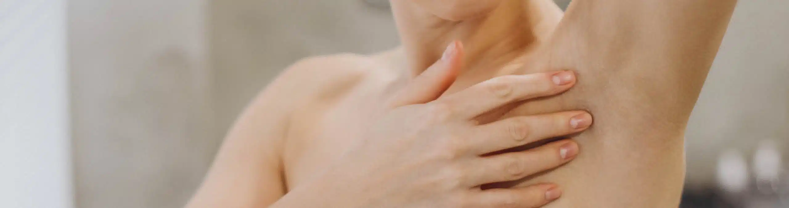 Woman showing an irritated underarm