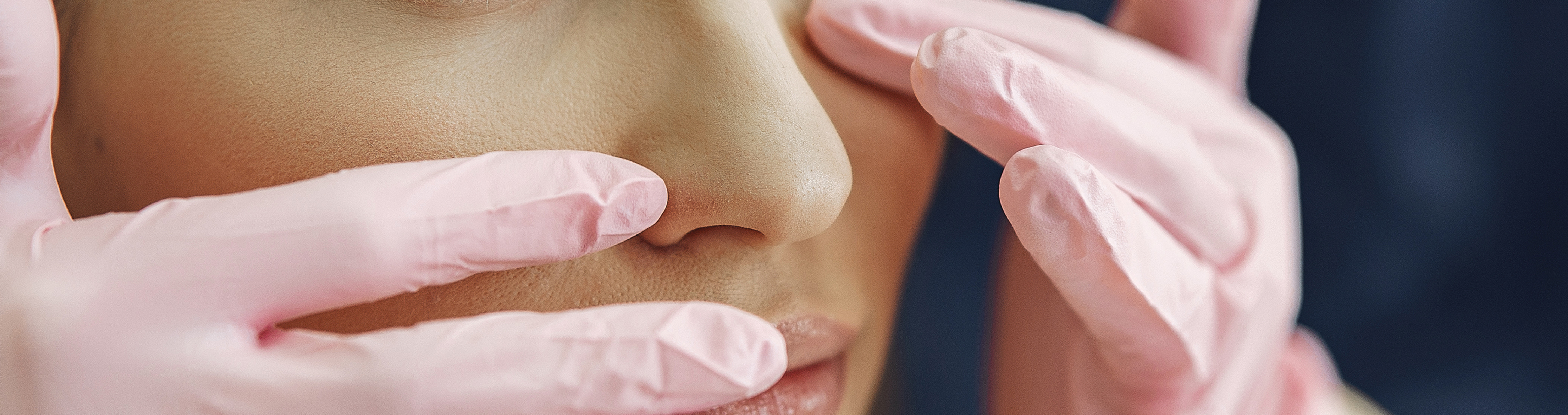 Rhinoplasty at Battersea Hospital