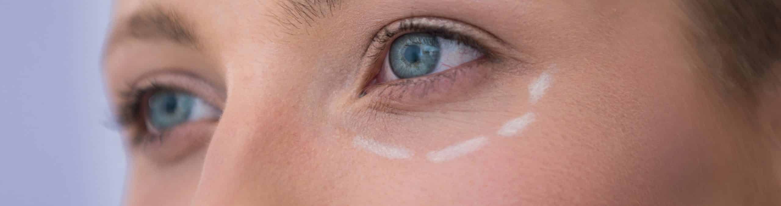 Woman with marks drawn cosmetic treatment 1